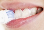 Отбеливающие зубные пасты.
Как избавиться от темных пятен на зубах? Продающиеся без рецептов зубные пасты, гели и жидкости могут помочь удалить темный налет с зубов. Большинство этих продуктов содержат абразивные, химические или полирующие вещества. В отличие от отбеливателей, они не меняют цвет зубов. Некоторые отбеливающие зубные пасты работают вместе с перекисью или пищевой содой – отбеливая зубы путем легкого обесцвечивания.