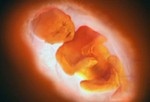 Развитие эмбриона на 36 неделе.
На этом этапе вес детей отличается. Все зависит от многих факторов: пола ребенка, количества вынашиваемых детей, роста и веса родителей. В среднем рост ребенка около 32 см, а вес – около 2,5 кг. Начинает быстро развиваться мозг. Практически полностью сформированы легкие. Начиная с этого момента ребенок находится вниз головой. Беременность считается «в срок», как только прошли 37 недель. Ребенок готов родиться!
