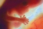 Развитие эмбриона на 12 неделе.
Плод вырастает до размера 6,5 см. В этот период плод начинает делать движения. Матка находится на уровне тазовых костей. С помощью специальных инструментов можно уже прощупать сердцебиение ребенка. Половые органы ребенка становятся более выразительными.