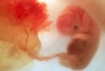 Развитие эмбриона на 8 неделе.
Ребенок уже размером с виноградинку – около 2,5 см. Формируются веки и уши. Уже отчетливо виден кончик носа. Руки и ноги почти полностью сформированы. Пальчики на руках и ногах продолжают расти, можно различить отдельные пальчики.