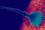 Зачатие.
Когда сперматозоид встречается с яйцеклеткой, он ее оплодотворяет. Этот процесс называется зачатие. В этот момент завершается организация генетического материала, включая пол ребенка. В течение трех дней после зачатия, оплодотворенная яйцеклетка (которая с этого момента начинает быстро делиться на множество клеток) проходит через фаллопиевы (маточные) трубы в матку, где крепится к маточной стенке. В этот же момент начинает формироваться плацента, которая будет питать малыша.